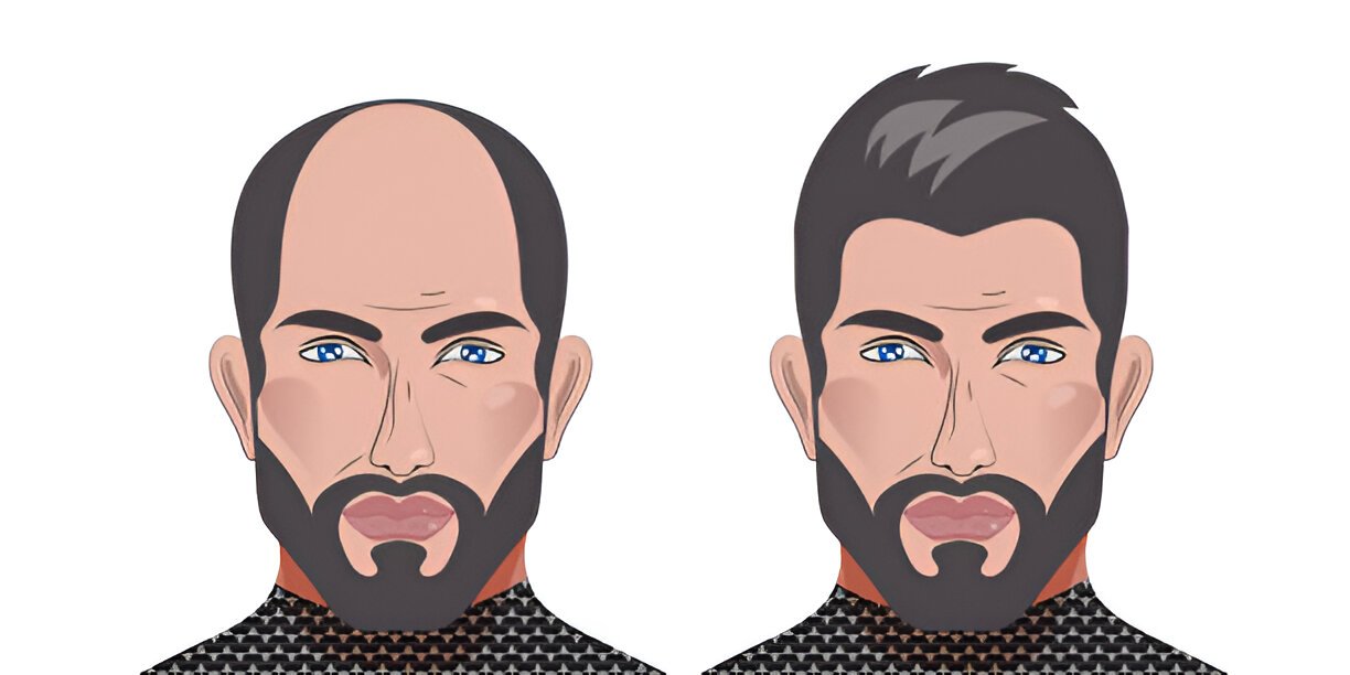 Hair fall treatment salon Prayagraj